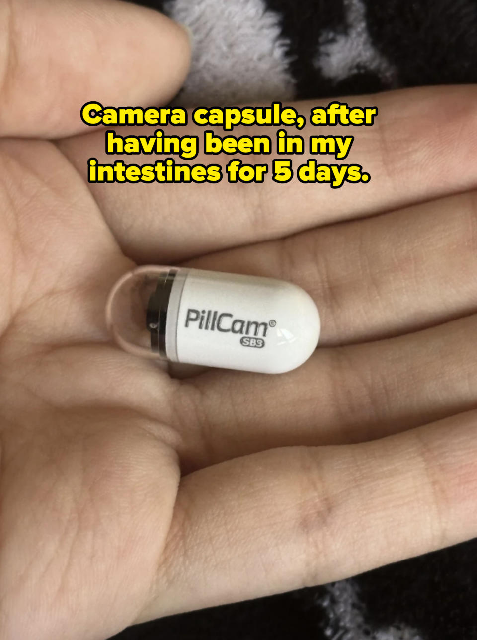 A hand holds a PillCam device, a small, capsule-shaped medical camera used for internal examinations