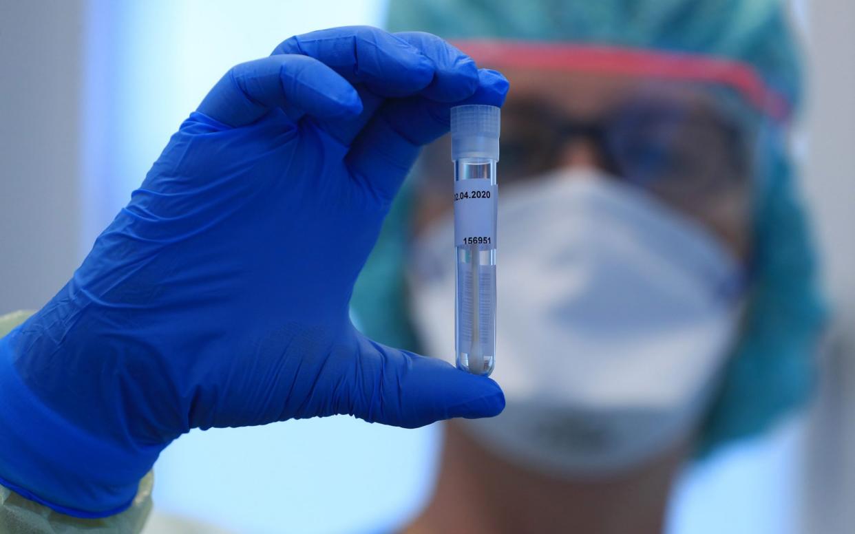 Saliva tests for coronavirus could help ministers meet Boris Johnson's 24-hour target  - Krisztian Bocsi 