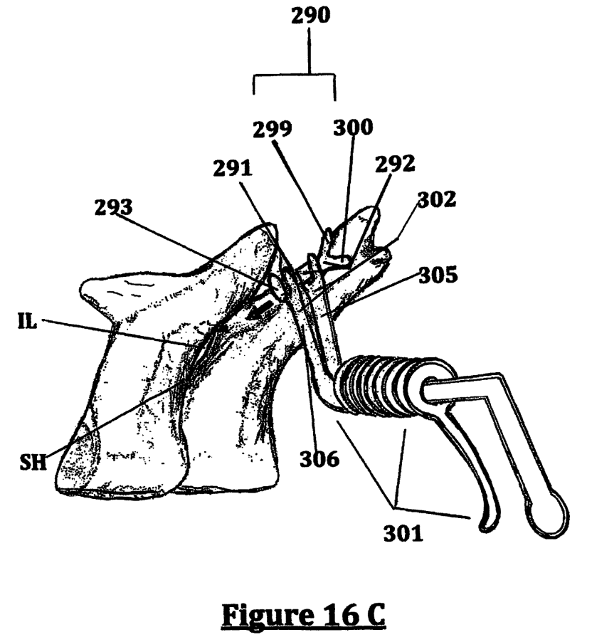 Image taken from the Cervi-Lok patent filing