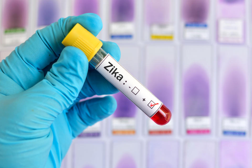 Blood sample positive with Zika virus