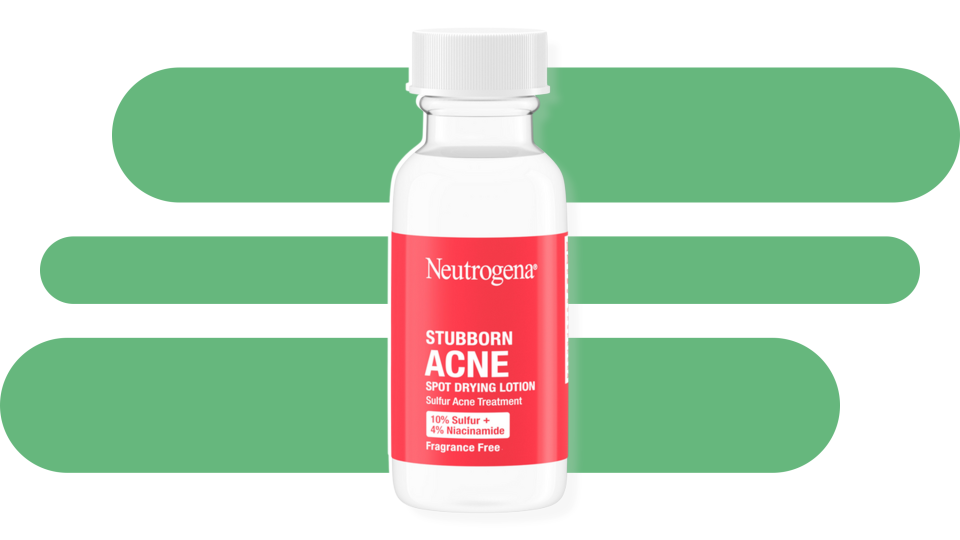 Kiss pesky pimples goodbye with the Neutrogena Stubborn Acne Spot Drying Lotion.