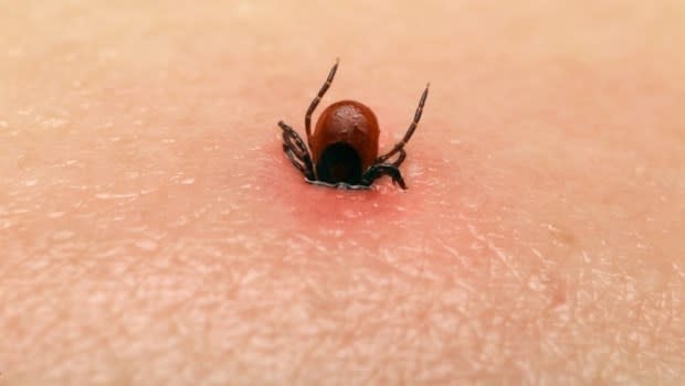 伊拉克今年已有111人遭蜱蟲咬傷、確診「出血熱」，且有19人不幸病逝。（圖／翻攝自維基百科）