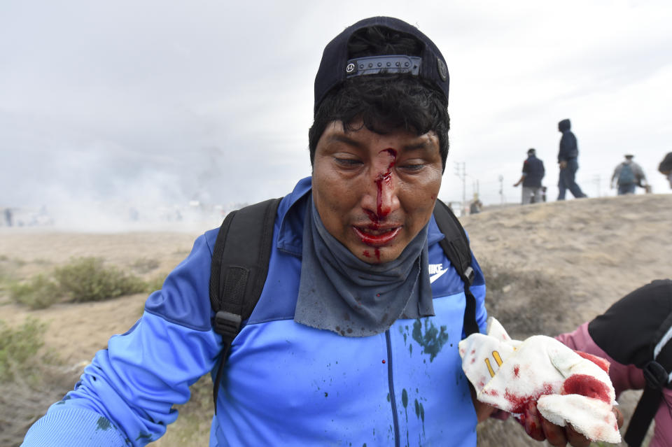 People aid a man injured during anti-government protests in Arequipa, Peru, Thursday, Jan. 19, 2023. Protesters are seeking immediate elections, President Dina Boluarte's resignation, the release of ousted President Pedro Castillo and justice for demonstrators killed in clashes with police. (AP Photo/Jose Sotomayor)