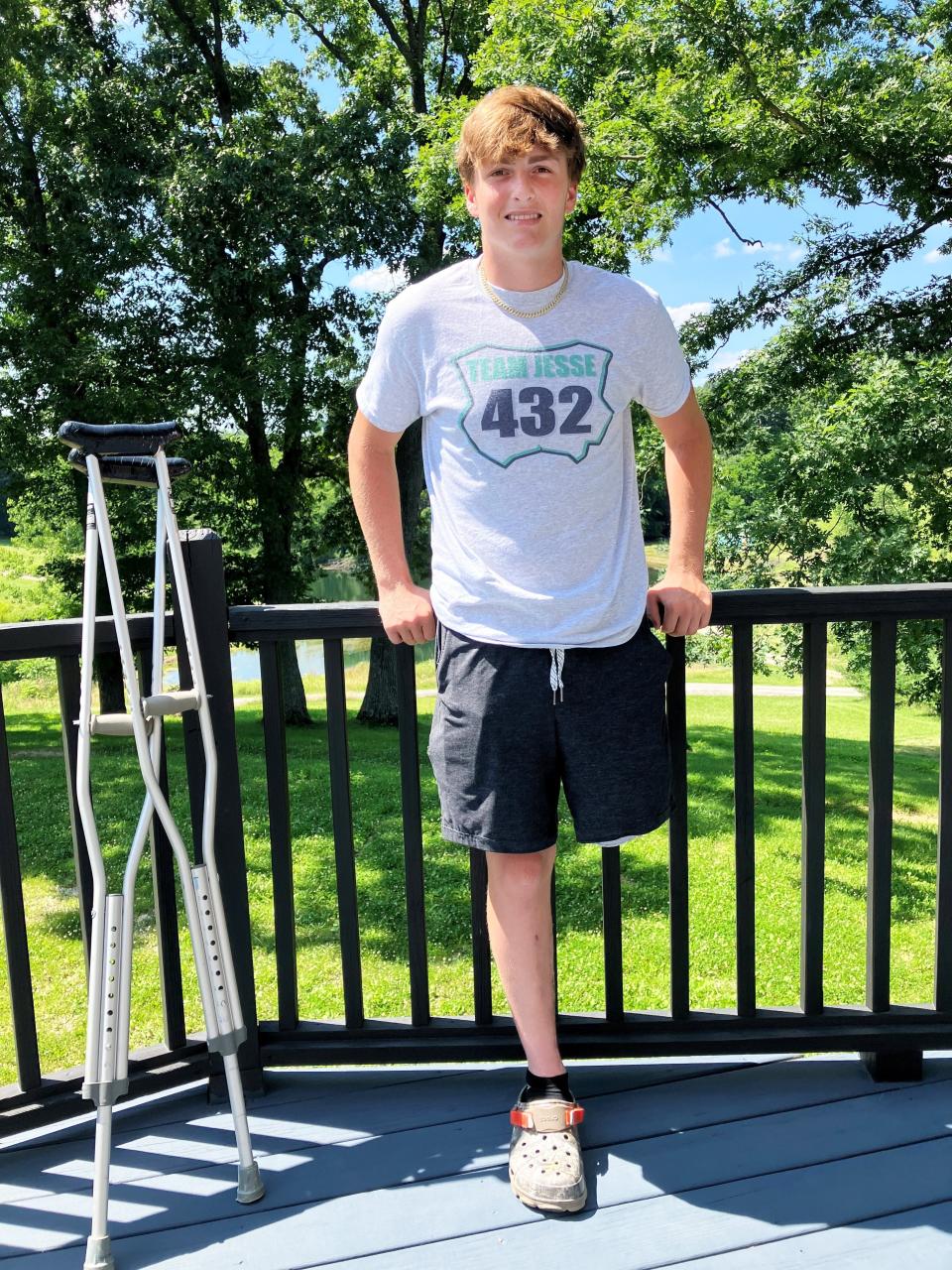 West Muskingum student Jesse Savage, 15, recently underwent amputation surgery as the result of a motorcyle crash on June 18 at Grear's Motorsports Park near Zanesville. Savage underwent three surgeries in six days at Nationwide Children's Hospital in Columbus.