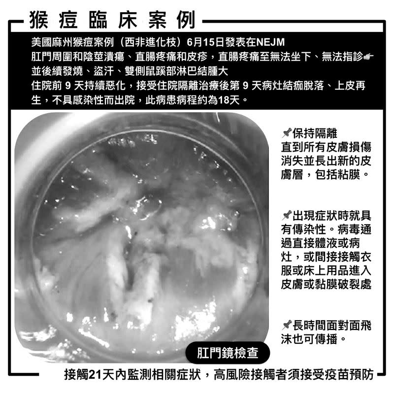 姜冠宇分享外國猴痘病例及相關注意事項。（圖／黑白處理，翻攝自姜冠宇臉書）