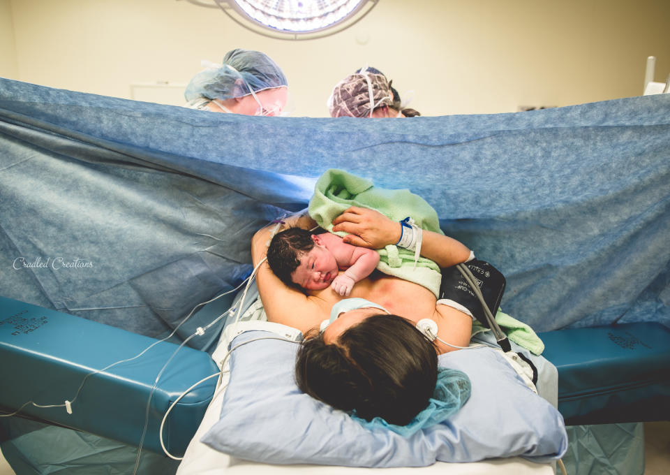 "This mom had 20 blissful minutes of snuggles and eye contact before the nurses took her baby to be diapered, weighed and measured. Then the baby was immediately returned to mom so they could travel to the recovery room together." 