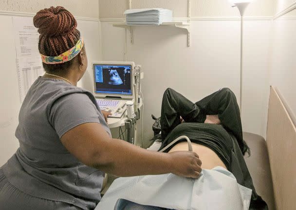 PHOTO: An operating room technician performs an ultrasound on a patient at Hope Medical Group for Women in Shreveport, La., July 6, 2022. (Ted Jackson/AP)