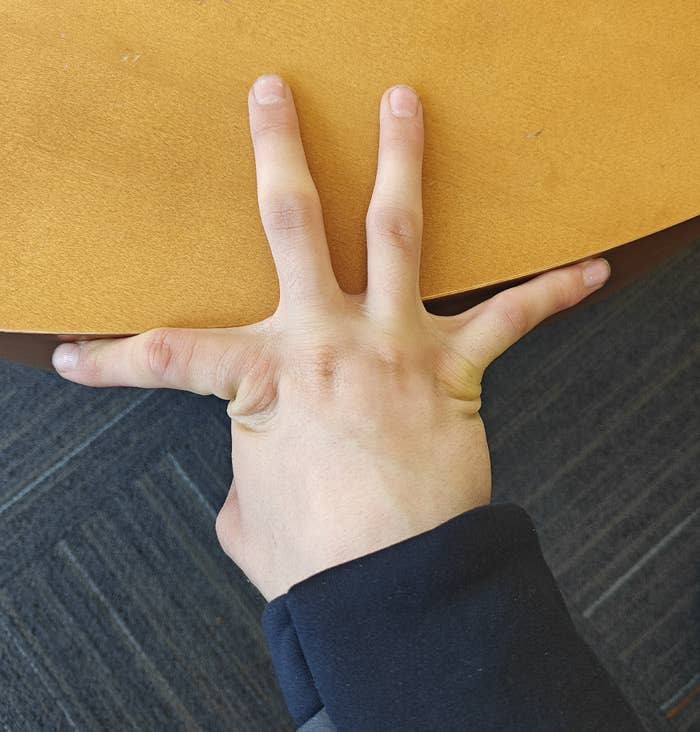 Person's fingers stretched in opposite directions