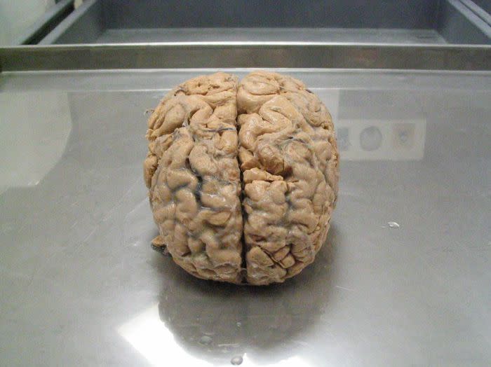 Brain