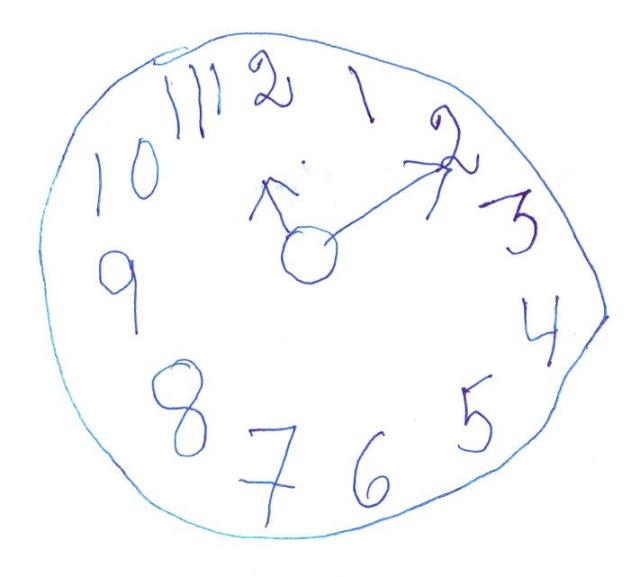 Relojes para mostrar lo que a menudo “olvidamos” del Alzheimer