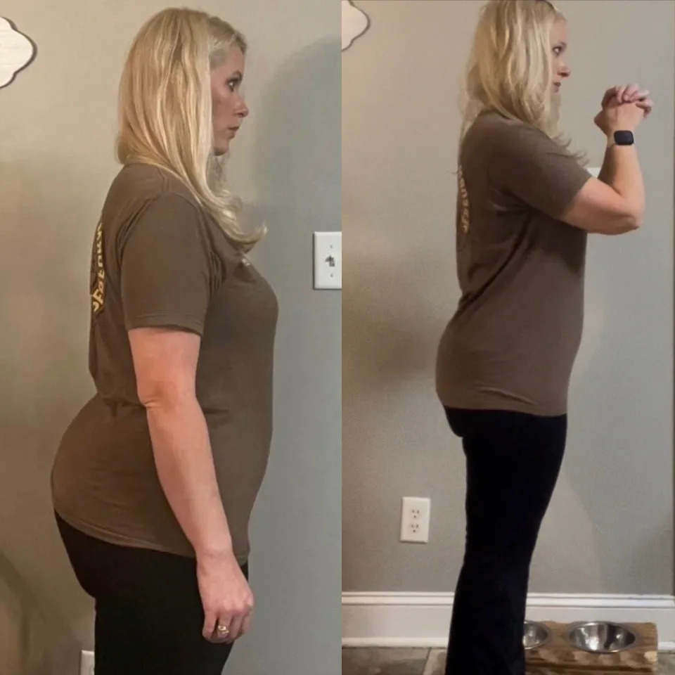 Staci Rice before and after six months on semaglutide