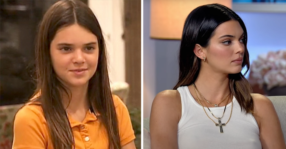 Kendall Jenner before and after