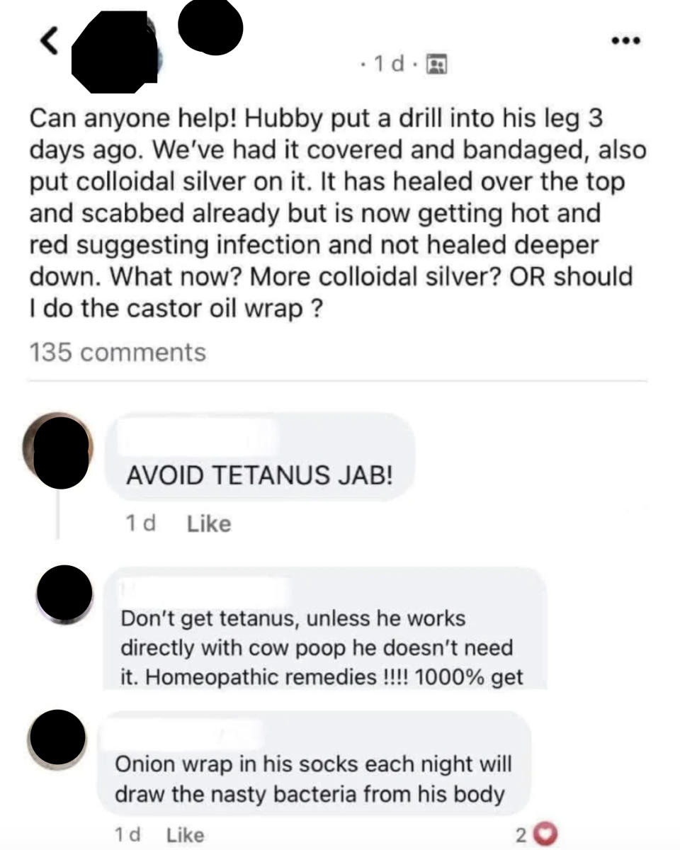 Facebook post asking for advice on a leg injury from a drill. Various comments offer remedies like avoiding a tetanus jab, using homeopathic remedies, and onion wraps