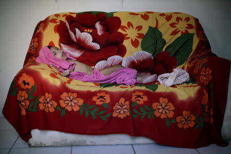 Luana Vieira, who is two years old, and was born with microcephaly, lies on a sofa after bath at her house in Olinda, Brazil, August 6, 2018. REUTERS/Ueslei Marcelino/Files