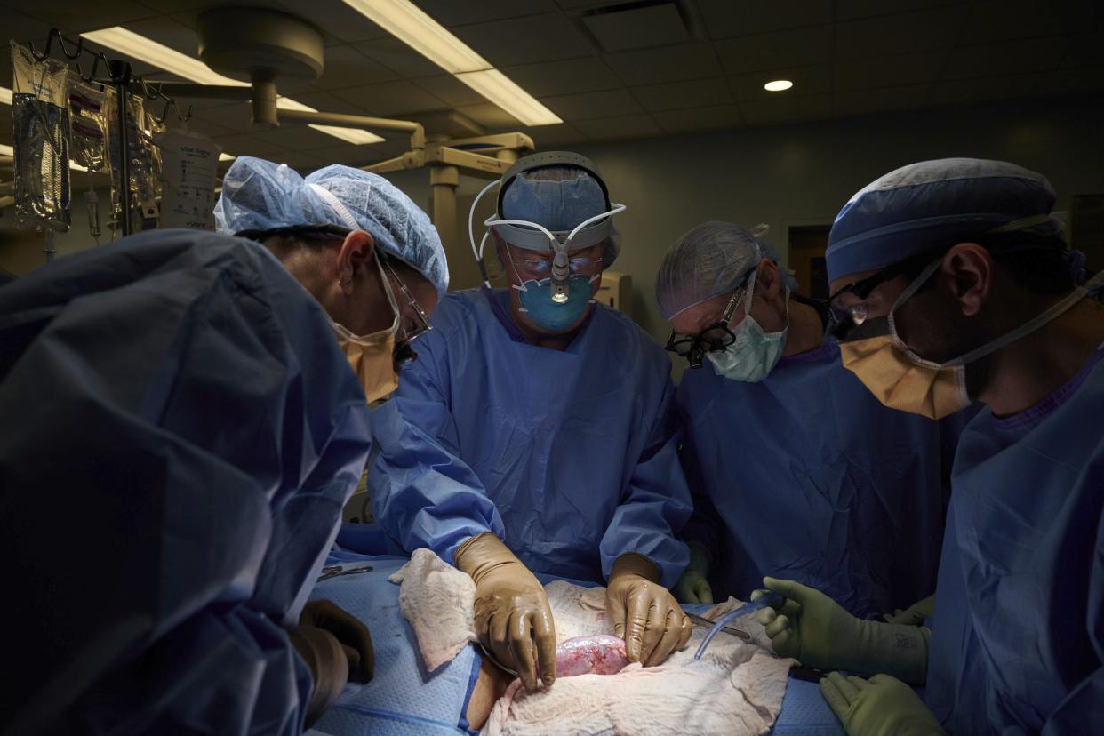 In this photo provided by NYU Langone Health, a surgical team at the hospital in New York examines a pig kidney attached to the body of a deceased recipient for any signs of rejection. From left are Drs. Zoe A. Stewart-Lewis, Robert A. Montgomery, Bonnie E. Lonze and Jeffrey Stern. (Joe Carrotta/NYU Langone Health via AP)