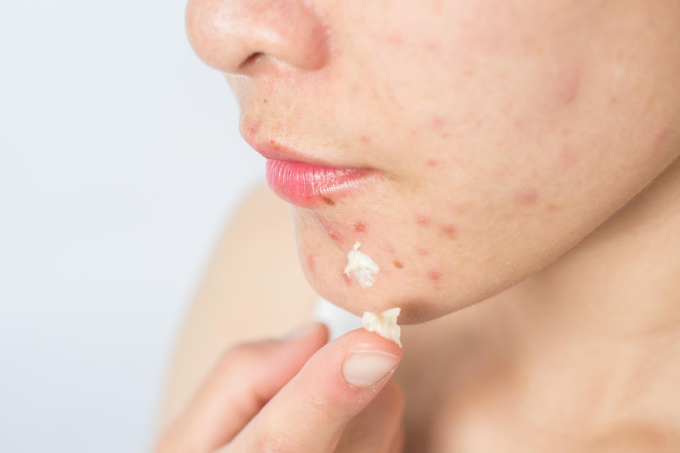 敏感肌保養怎麼做才好？敏感肌洗面乳、保養品這樣挑 保護敏感肌（圖／Getty Images）