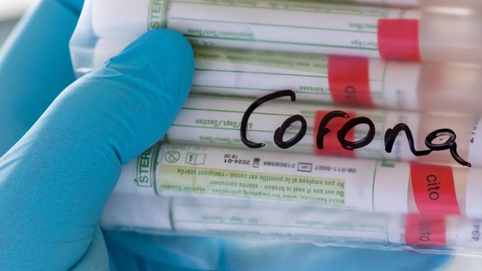 Proben für Corona-Tests in Plauen: Seit Beginn der Corona-Krise haben sich in Deutschand nachweislich 181.482 Menschen mit Sars-CoV-2 angesteckt (Datenstand 31.05. 0 Uhr).