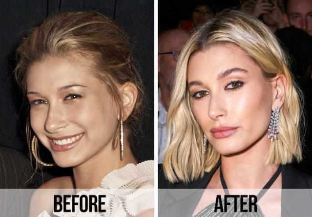 Fans Think Hailey Bieber Had A Nose Job And A 'Surgical Lip Flip'