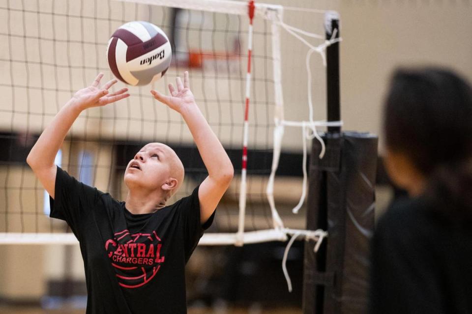 Keller Central volleyball player Allison Montoya has alopecia, but continues to excel as setter.