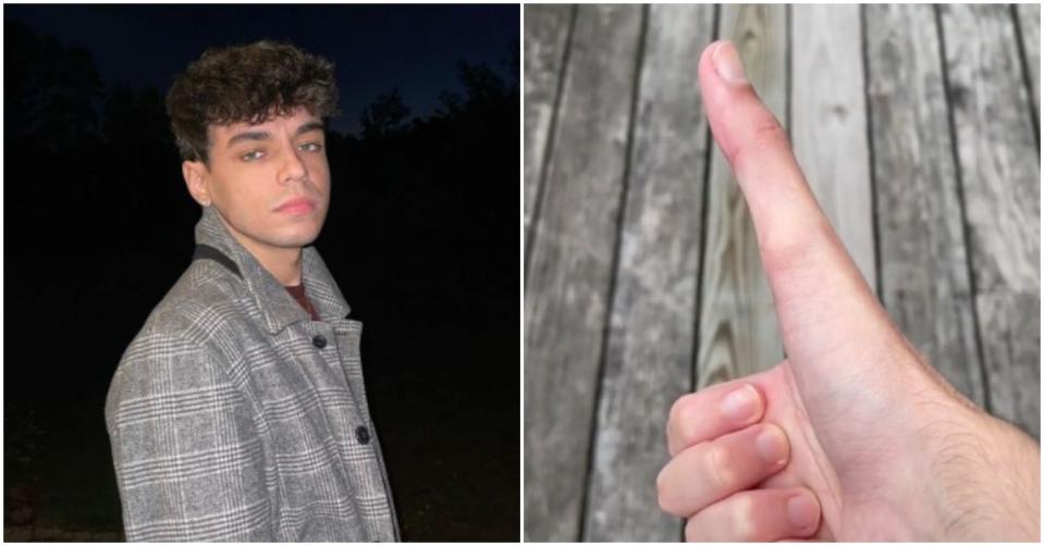 23歲的美國男子雅各，可以把拇指伸得超長。（翻攝自雅各IG、TikTok）
