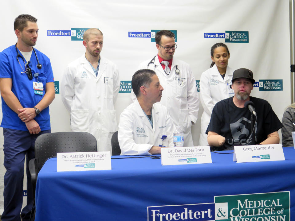 Greg Manteufel, right, sits surrounded by the medical staff at Froedtert & the Medical College of Wisconsin on Tuesday, Oct.2, 2018, in Milwaukee, to talk about his recovery from a rare blood infection that led to the amputation of part of his forearms and legs. Doctors say the blood infection was caused by dog saliva. (AP Photo/Ivan Moreno)