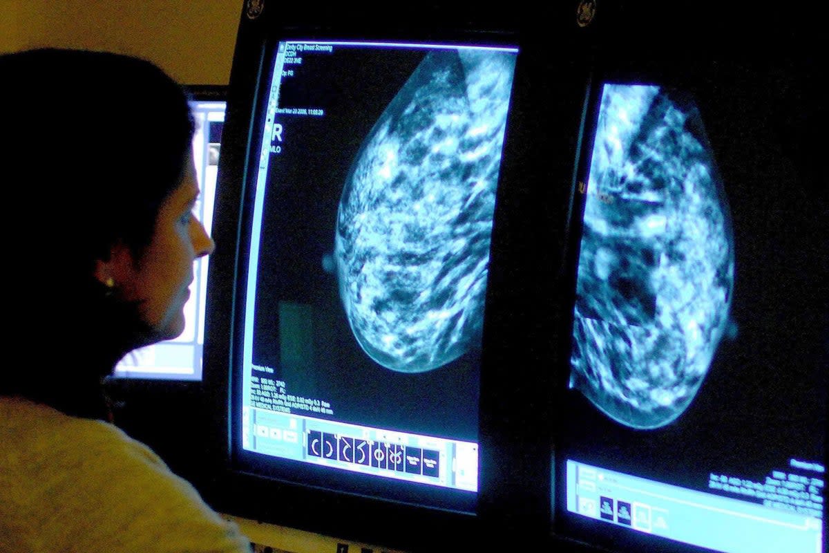 More than 22,000 patients have been waiting over two months to begin urgent cancer treatment (File picture)  (PA Wire)