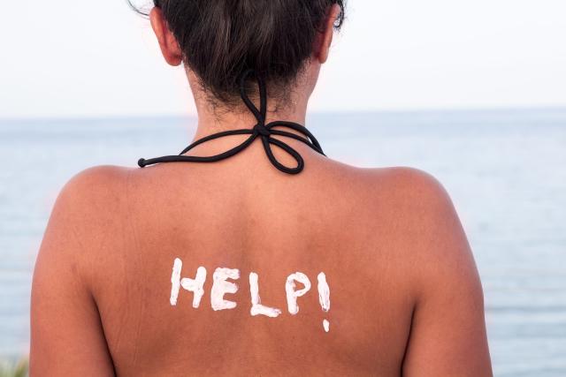 Does Vinegar Help Sunburn? No, It Could Actually Make It Worse