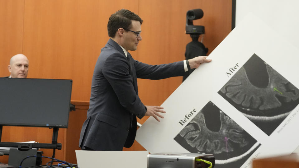 Paltrow attorney James Egan displays a poster showing a brain scan in the courtroom on Wednesday, March 29, 2023, in Park City, Utah. Paltrow's attorneys on Wednesday questioned medical experts about the injuries Terry Sanderson claims to have sustained when he and Paltrow collided at Deer Valley Resort seven years ago. (AP Photo/Rick Bowmer, Pool)