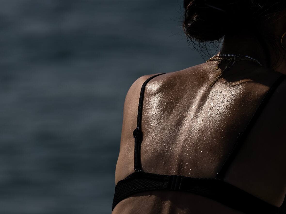 Sweat beads are seen on the back of a woman on Dec. 9, 2023, in Sydney, Australia. A new wave of whole-body deodorants swear they can help with sweat and smell — everywhere. (Jenny Evans/Getty Images - image credit)