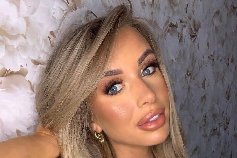 Faye Winter's lip filler became a talking point on Love Island