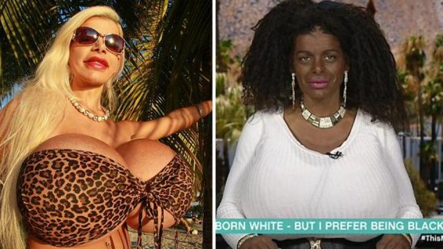 white model who turned herself black wants African nose - Yahoo Sports