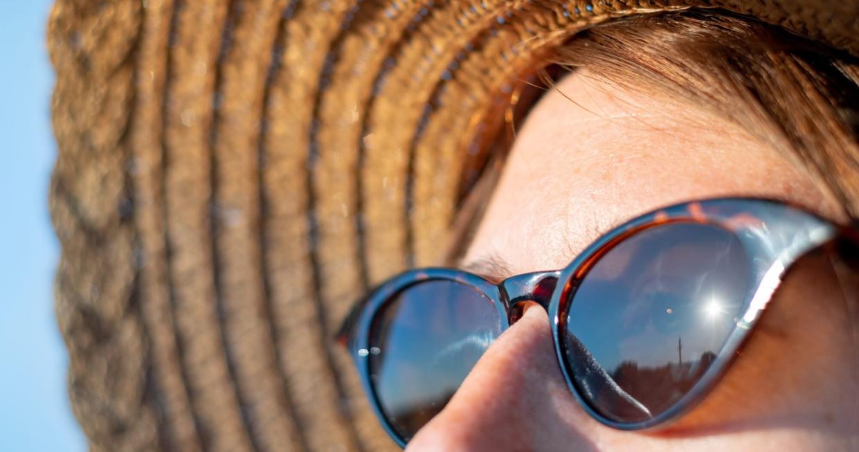 Forehead of a woman with freckles in direct sunlight, wearing cat-eye sunglasses and a woven sun hat