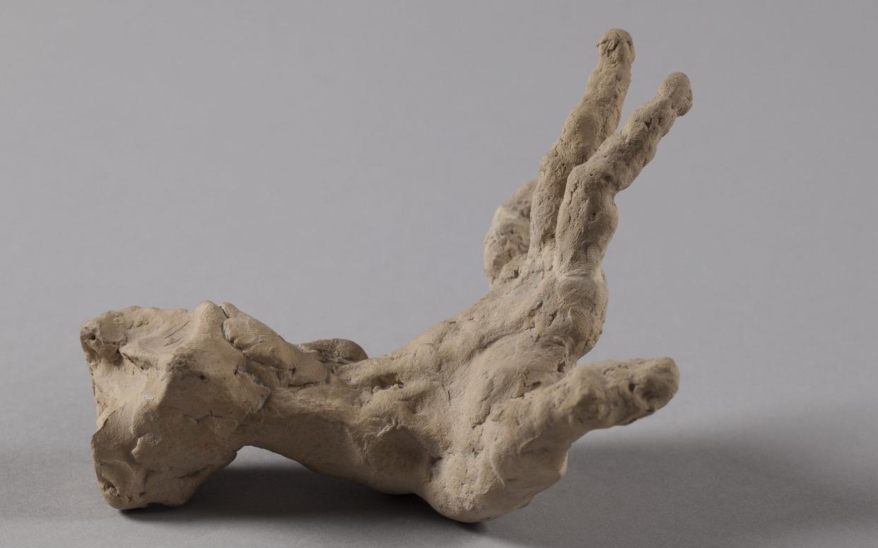 Critics compared Rodin's tiny sculptures of hands and limbs, which he called 'giblets', to exhibits in museums of anatomy and pathology - Musée Rodin