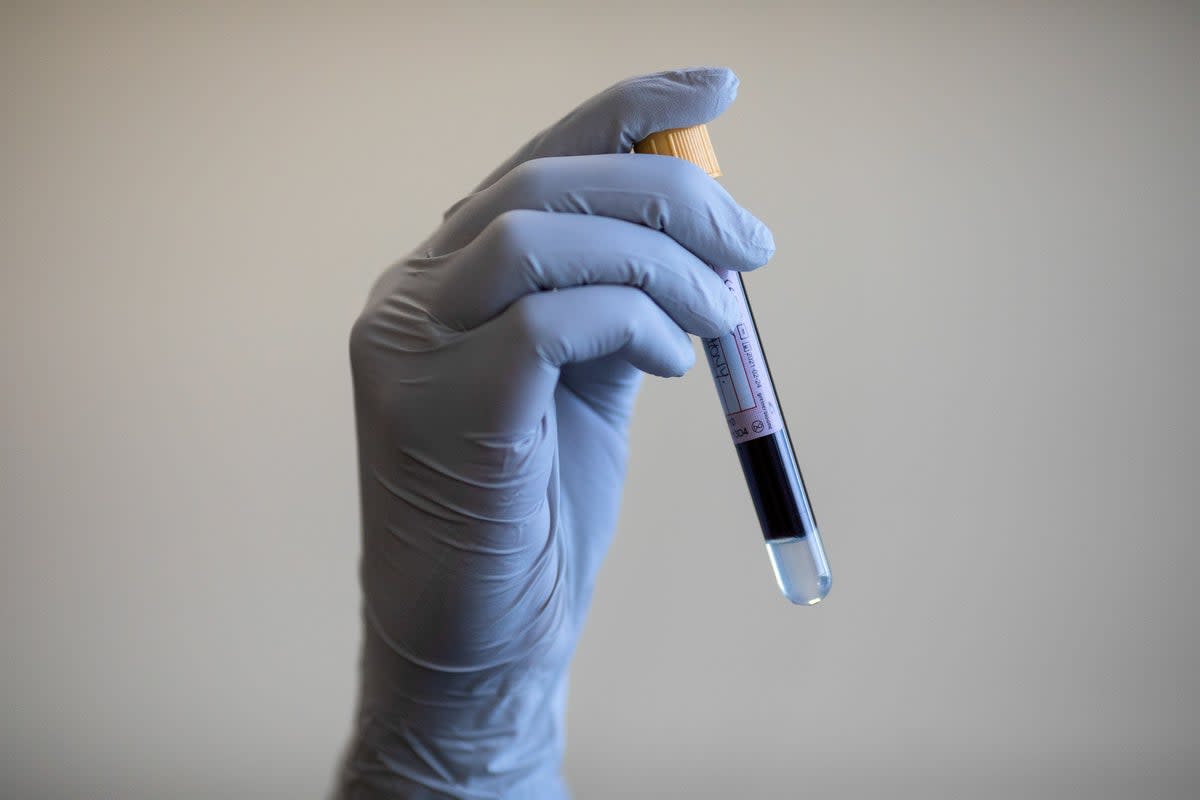 File photo of a person holding a test tube containing a blood sample (PA)