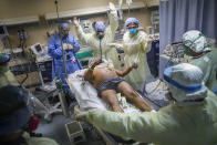 FILE - In this April 20, 2020, file photo, nurses and doctors clear the area before defibrillating a patient with COVID-19 who went into cardiac arrest at St. Joseph's Hospital in Yonkers, N.Y. The emergency room team successfully revived the patient. The worldwide death toll from the coronavirus eclipsed 1 million, nine months into a crisis that has devastated the global economy, tested world leaders' resolve, pitted science against politics and forced multitudes to change the way they live, learn and work. (AP Photo/John Minchillo, File)