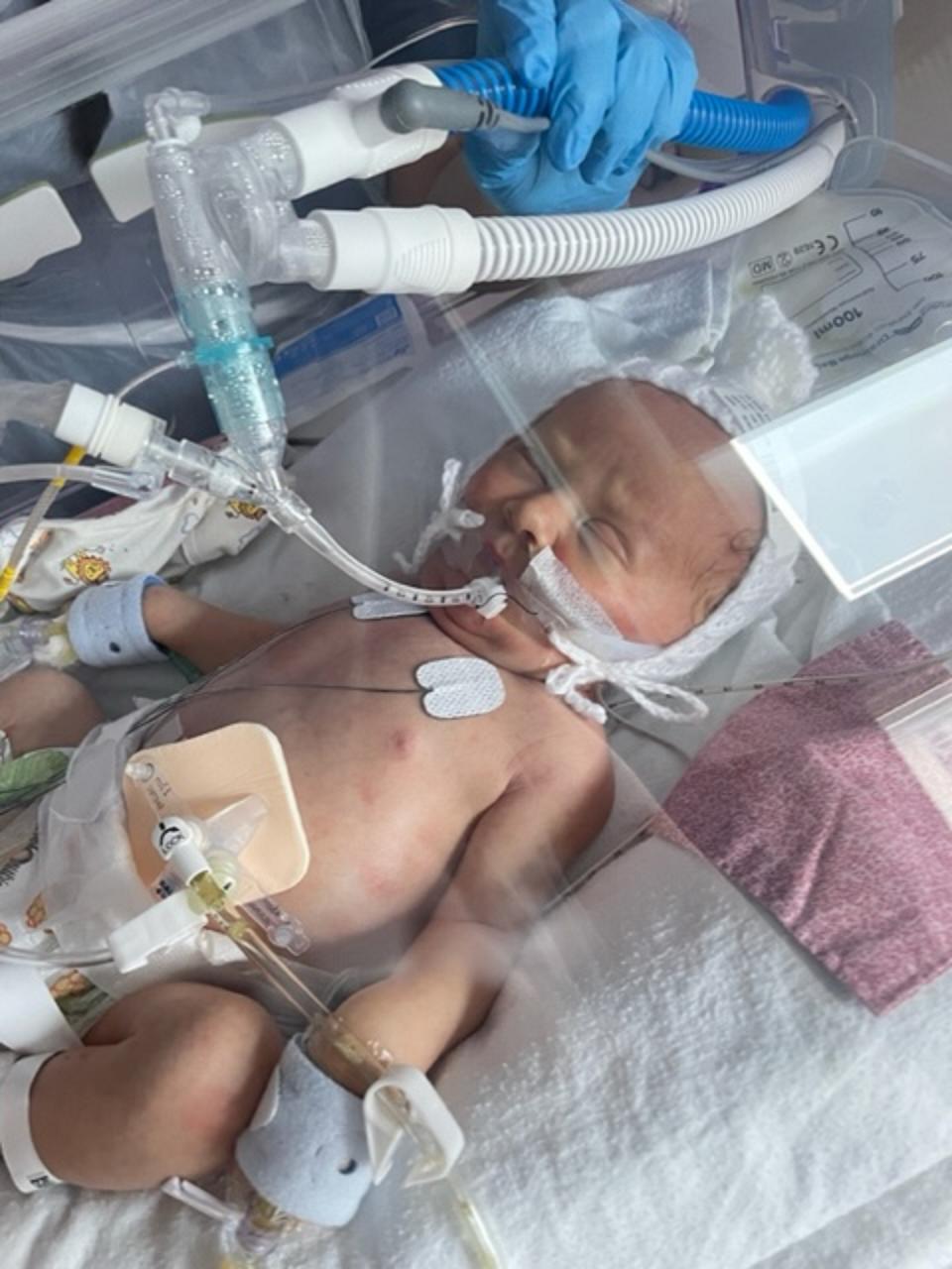 Baby Connie in intensive care