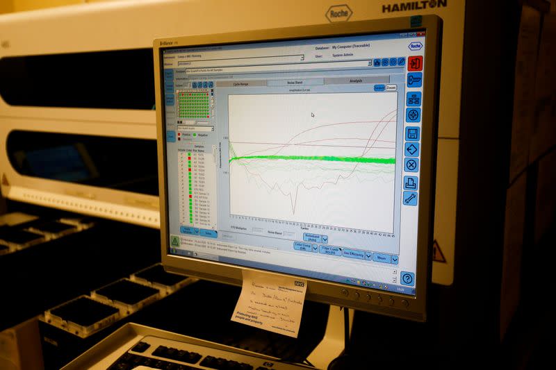 Results from a test for the novel coronavirus can be seen on a screen at the Microbiology department of North Devon District Hospital in Barnstaple