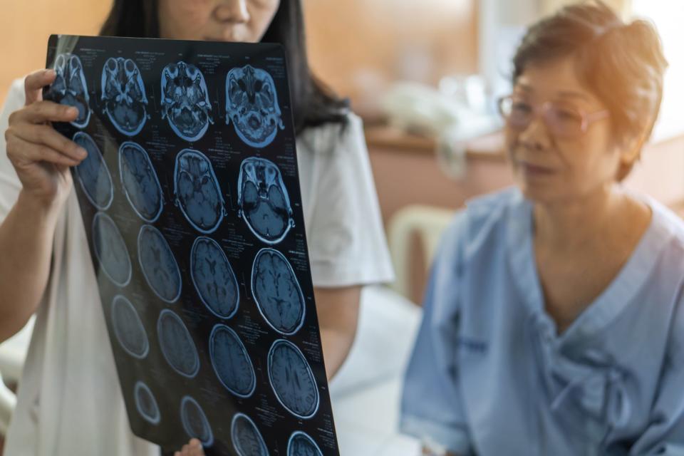 A neurologist shows an X-ray to a patient.