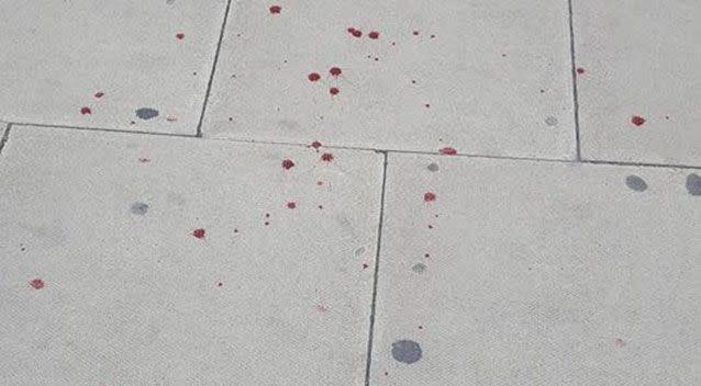 A witness posted this photo saying the dog was bleeding after the attack. Source: Facebook