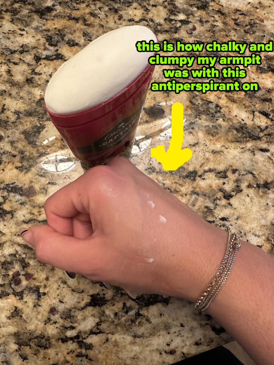 the clump of applied deodorant on the author's hand