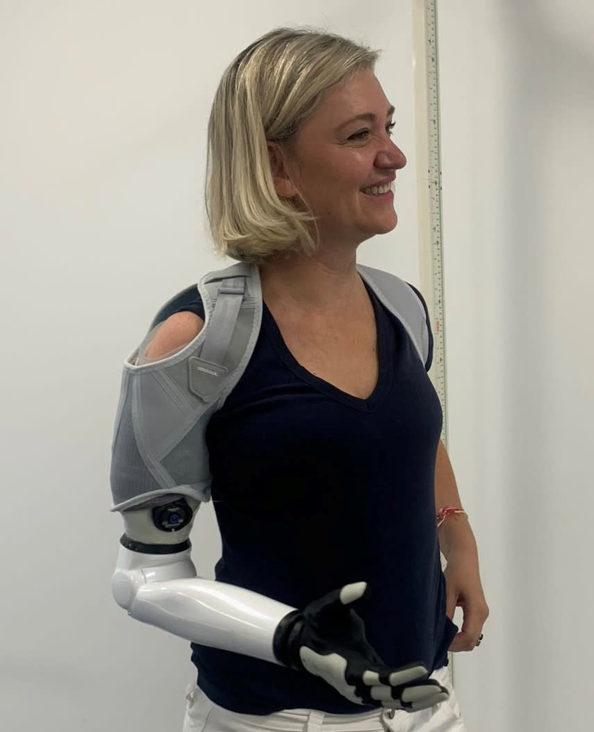 Sarah de Lagarde has a high-tech prosthetic arm, which was crowdfunded via a campaign her husband set up soon after her accident. (Supplied)