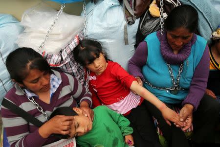 Residents of the town Cerro de Pasco in the Peruvian Andes show skin rash in their children's hands, as they protest for what they describe as rampant pollution from a sprawling polymetallic mine operated by Peruvian mining company Volcan, outside of the health ministry in Lima, Peru June 22, 2017. REUTERS/Mariana Bazo