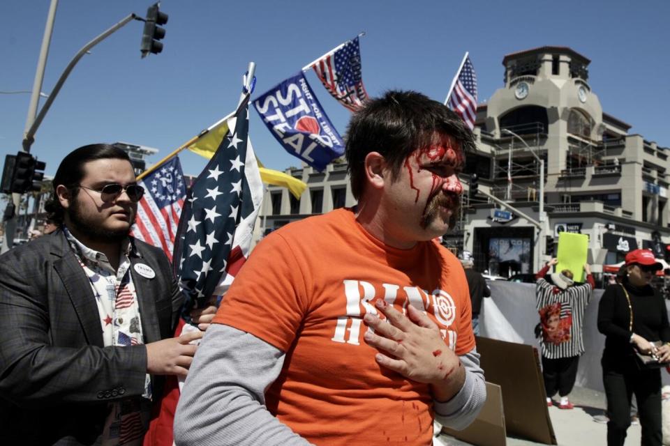 A man with an orange shirt and blood running down his forehead