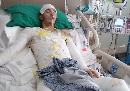 Jean Barreto was severely injured in the Feb. 27 incident. (Photo: NeJame Law)