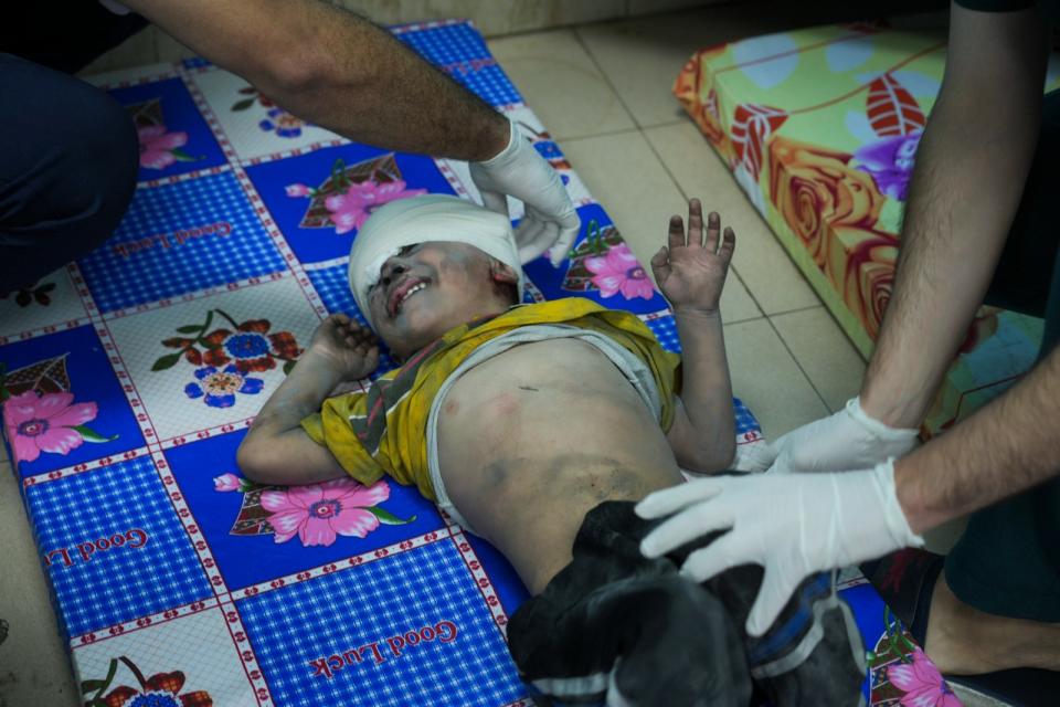 2023年10月17日，加薩走廊遭以色列空襲，一名兒童被送往中部代爾拜萊赫（Deir al-Balah）的醫院。美聯社
