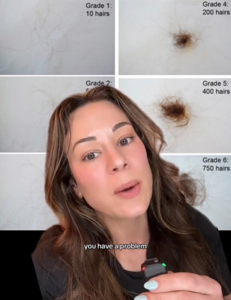 “If your hair starts looking like this, around 400 hairs, or it looks like this — this is around 750 hairs, you have a problem,” Zubritsky said in her 27-second TikTok clip. TikTok