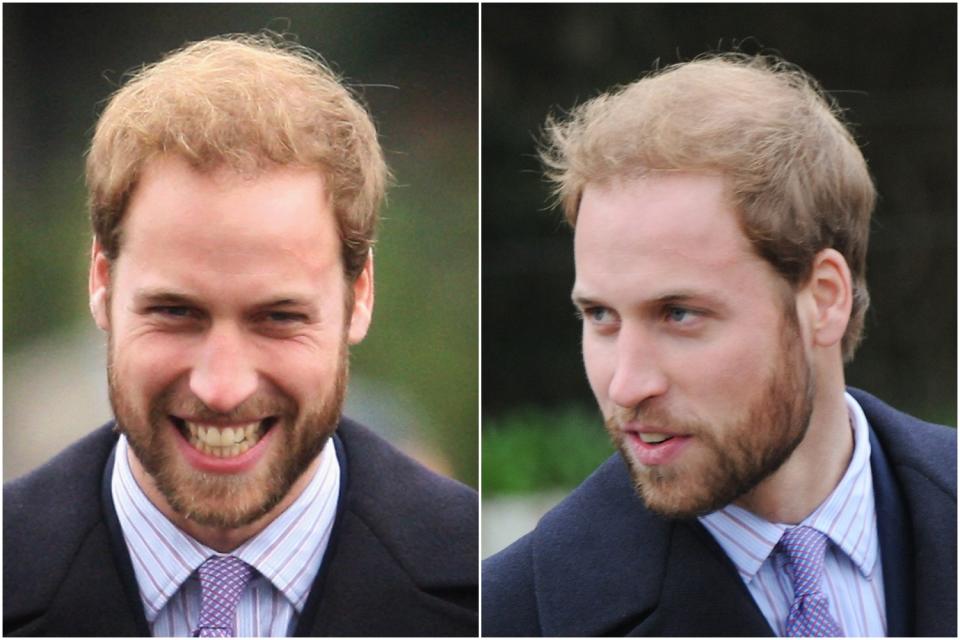 A composite image of Prince William with a beard in 2008. (Getty Images)