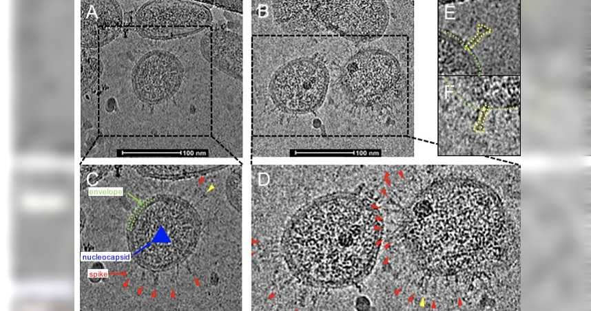 新冠病毒真實樣貌、與人體細胞發生融合畫面曝光。（圖／鳳凰網）