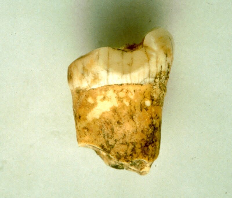 The tooth shows that the Neanderthal ate almost nothing but meat (Lourdes Montes) 