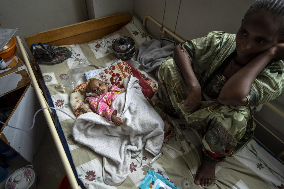 Birhan Etsana, 27, from Dengelat, sits with her malnourished baby, Mebrhit, who at 17 months old weighs just 5.2 kilograms (11 pounds and 7 ounces), at the Ayder Referral Hospital in Mekele, in the Tigray region of northern Ethiopia, on Monday, May 10, 2021. The lone survivor of her triplets, the infant was admitted with complications stemming from severe acute malnutrition, including heart failure. (AP Photo/Ben Curtis)